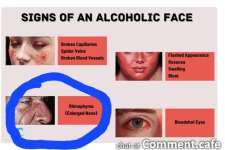 Signs-of-an-Alcoholic-Face-1024x576.jpg